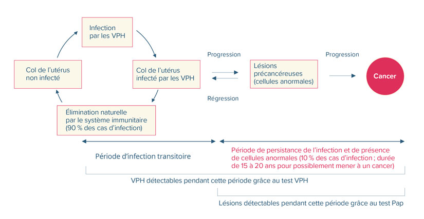 Schéma illustrant l’évolution d’une infection du col de l’utérus par les VPH, vers une élimination naturelle ou vers des lésions précancéreuses et éventuellement un cancer.